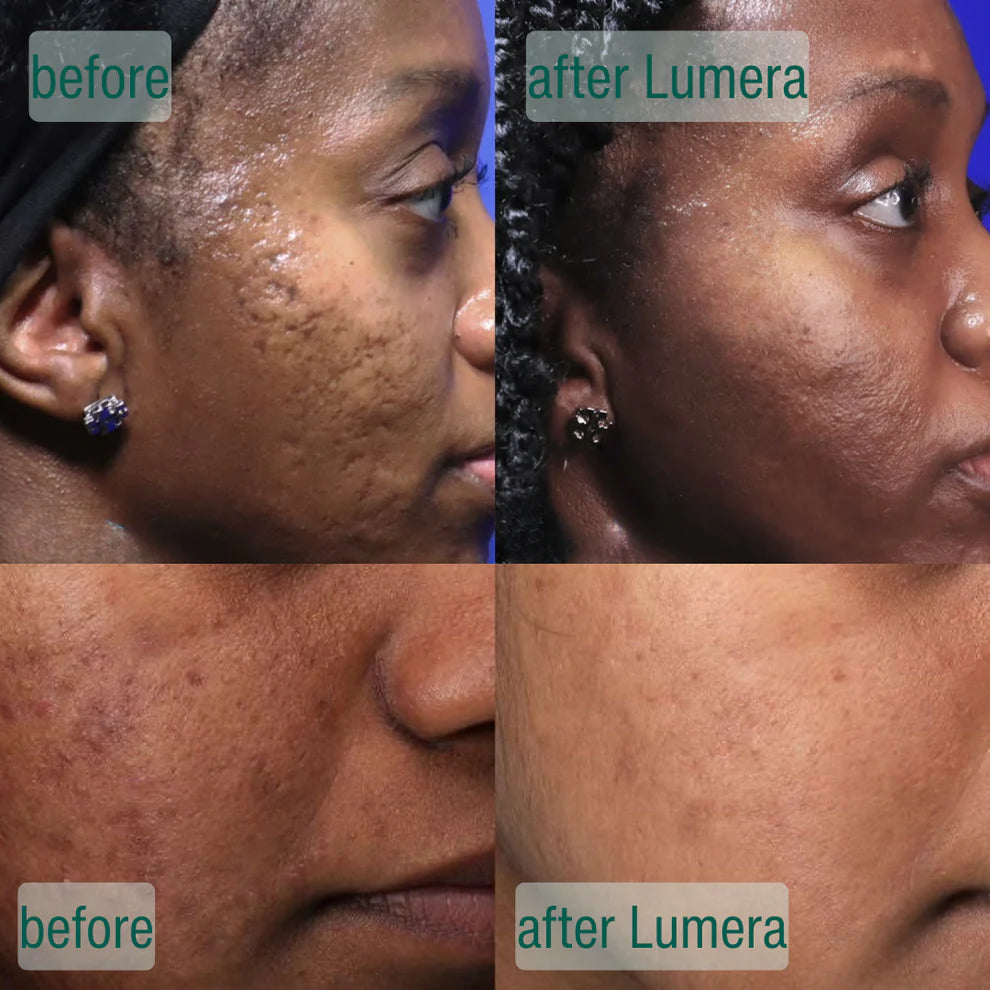 Microcrystal Serum PM Duo