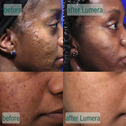 Microcrystal Serum PM Duo