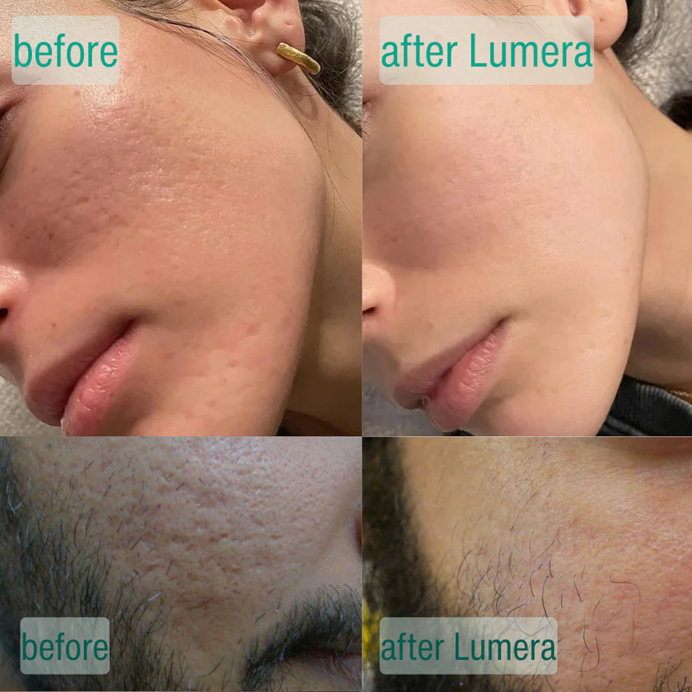 Microcrystal Serum PM Duo