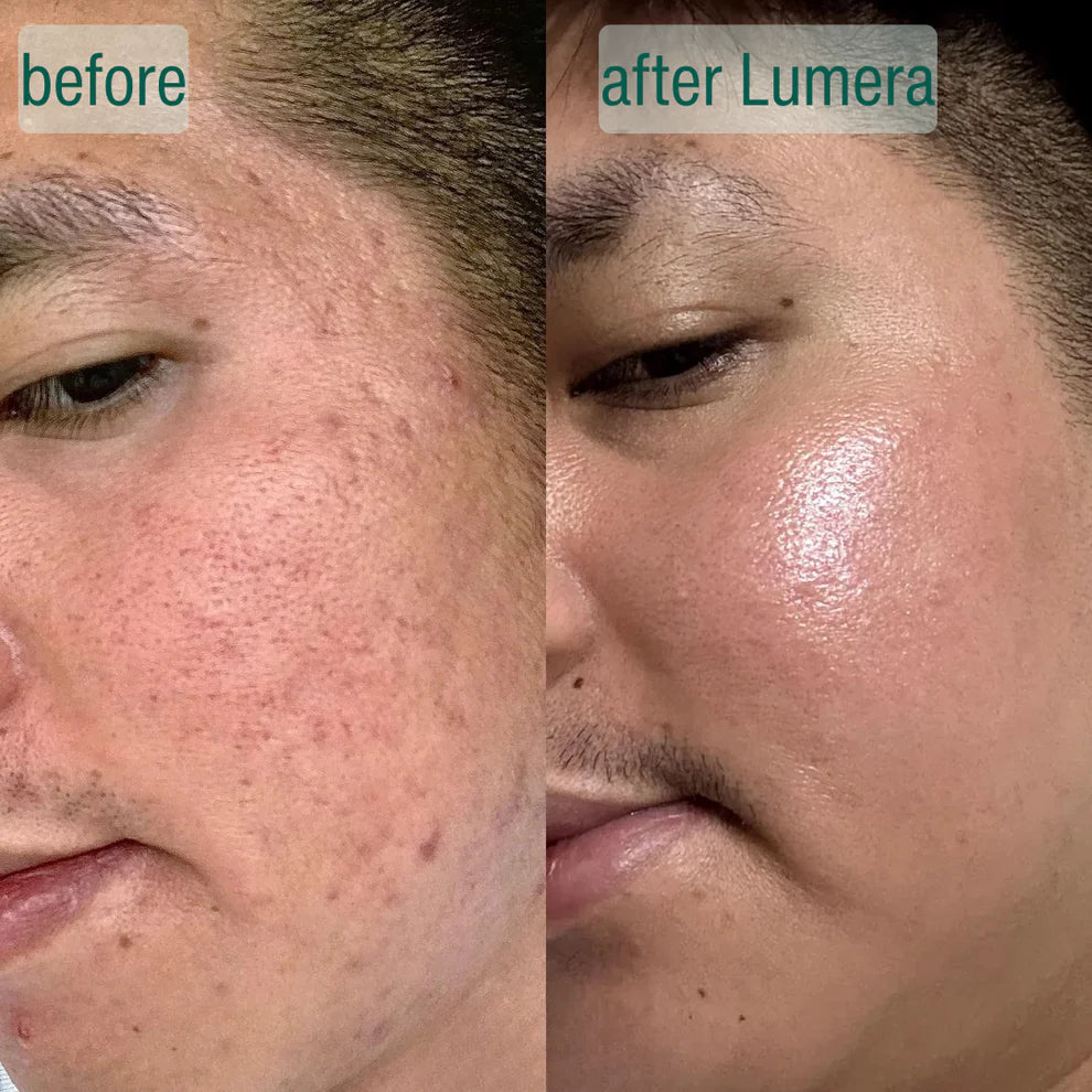 Microcrystal Serum PM Duo