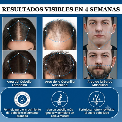 Aparthy Roll-On Crecimiento Capilar