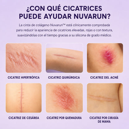 Cinta de silicona para cicatrices